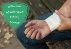بافت مثلثی فیبری-غضروفی (TFCC) چیست؟ | آشنایی با مثلث غضروفی لیگامانی کف دست