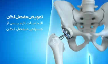 تعویض مفصل لگن | اقدامات لازم پس از جراحی مفصل لگن