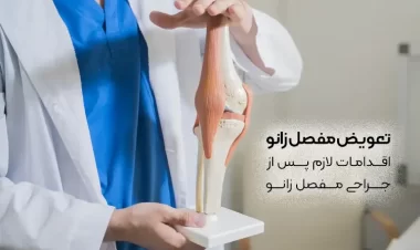 تعویض مفصل زانو | اقدامات لازم پس از جراحی مفصل زانو